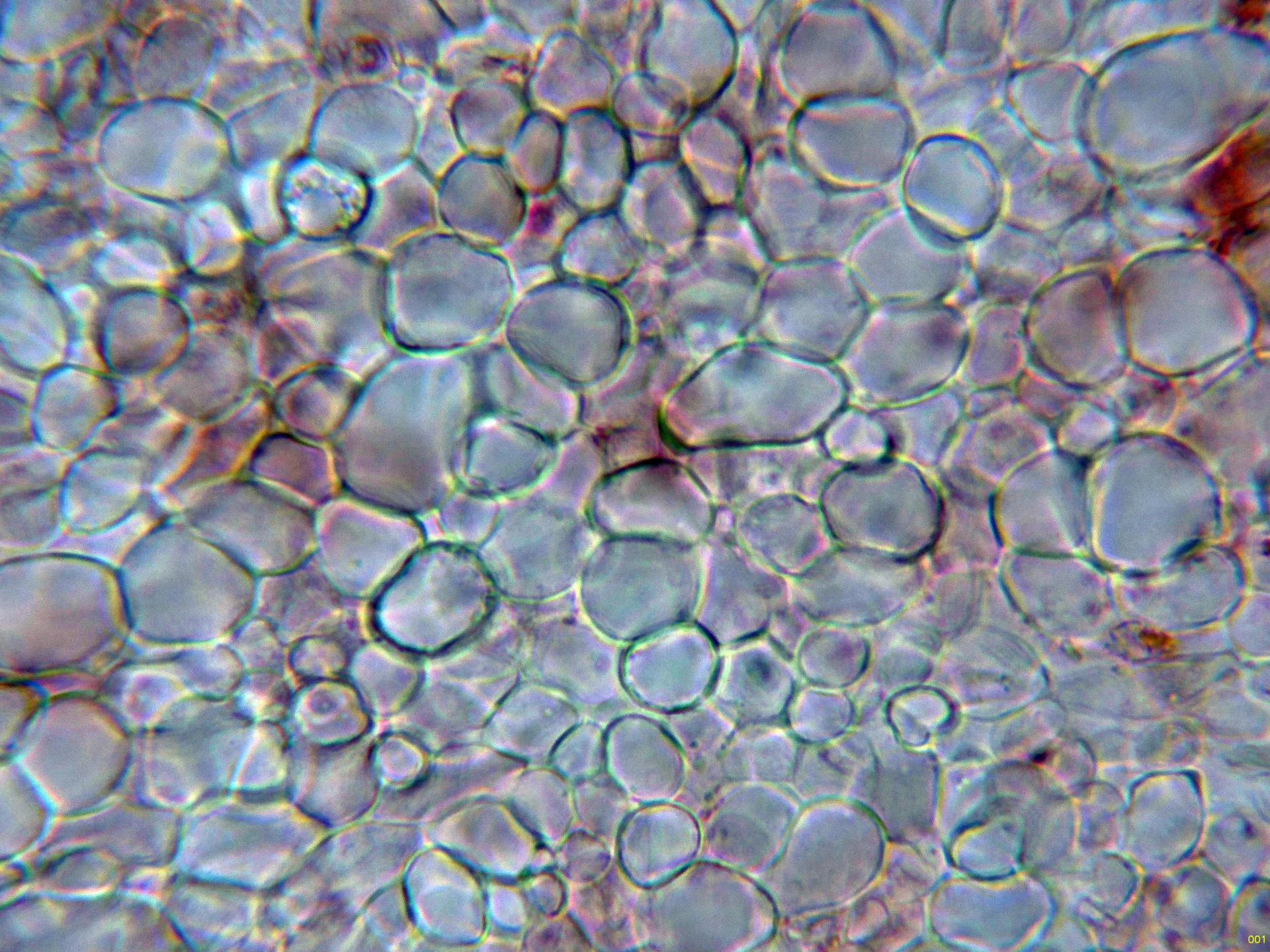 Microscopía de Orbilia leucostigma - 11 - Excípulo-001